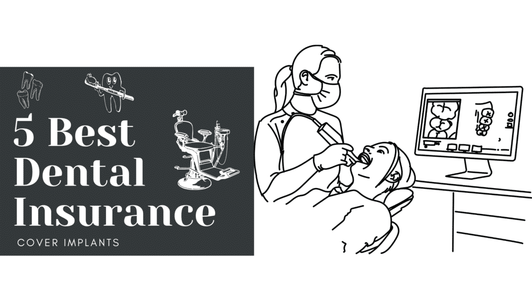 Dental Insurance Cover Implants